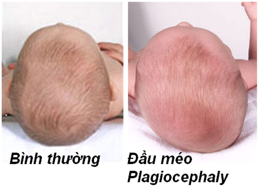 Mẹo vặt nuôi con khỏe mạnh