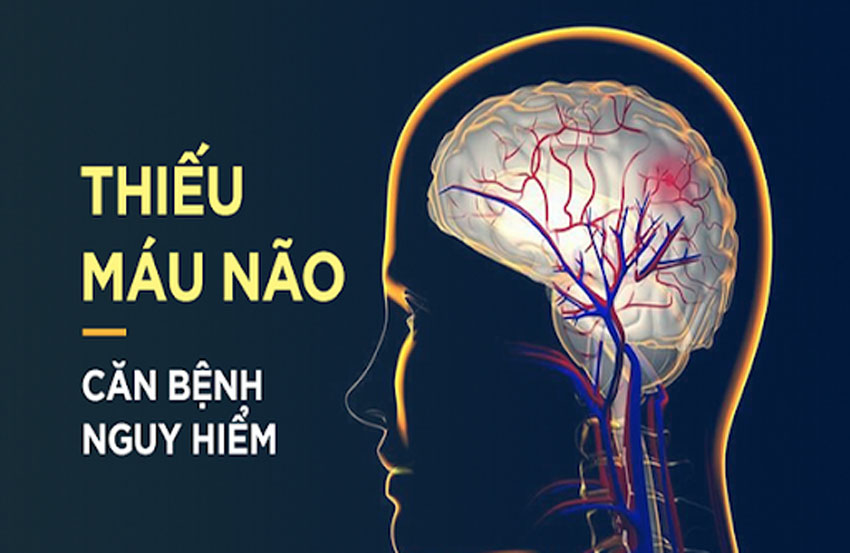 Bị thiếu máu não có nguy hiểm không
