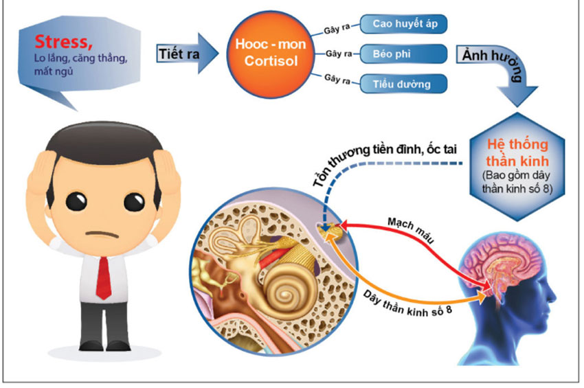 Rối loạn tiền đình có chữa khỏi được không?