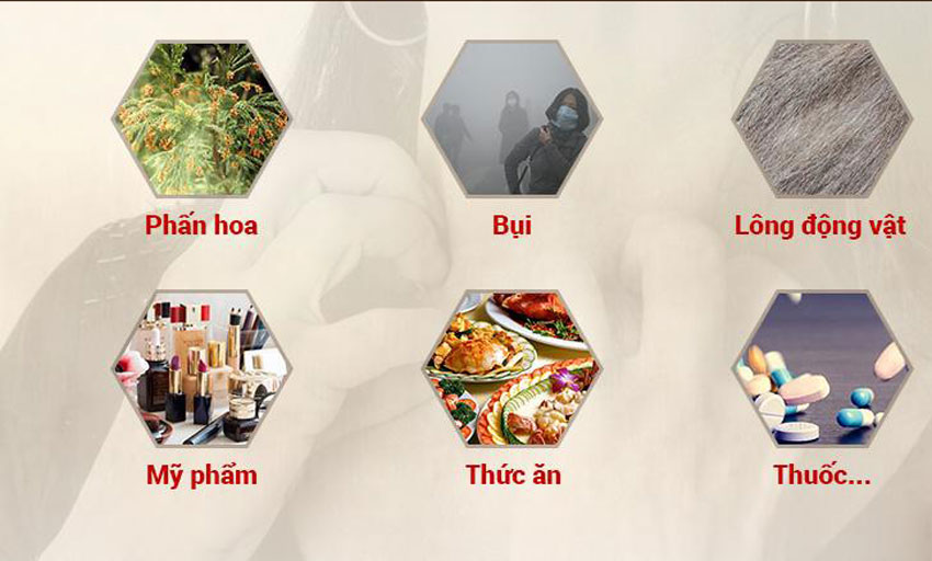 10 Cách chữa dị ứng da tại nhà hiệu quả