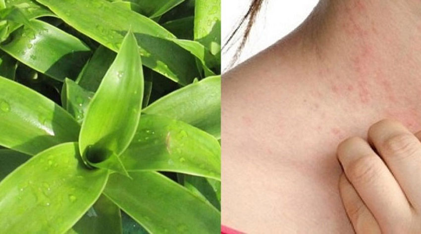 Cây lược vàng và 3 cách chữa vảy nến hiệu quả