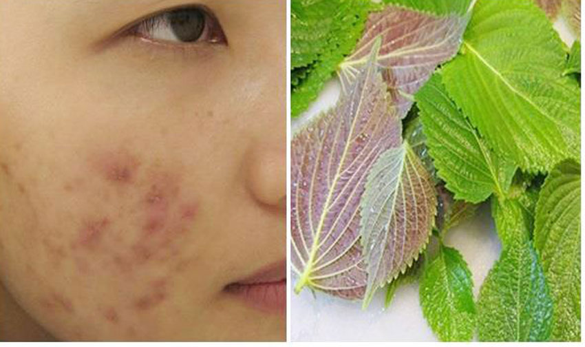 5 cách làm đẹp da bằng lá tía tô cực hay và hiệu quả