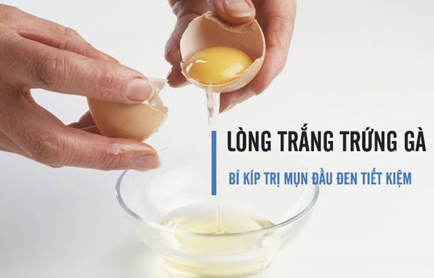 6 cách trị mụn đầu đen hiệu quả tại nhà