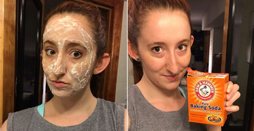 6 cách trị mụn đầu đen hiệu quả tại nhà