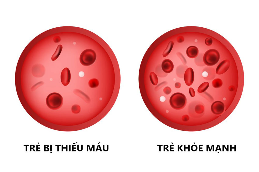 10 thực phẩm bổ máu dành cho người thiếu máu