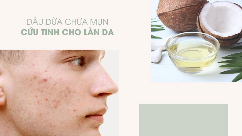 8 cách dưỡng da bằng dầu dừa 